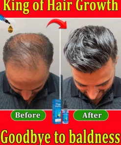 Hair growth essential oil